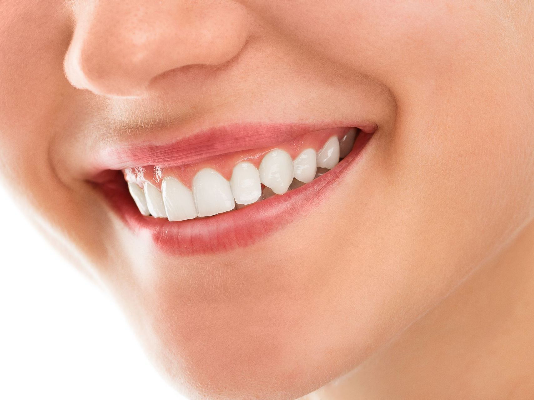 How Do I Keep My Teeth White After Whitening Treatment