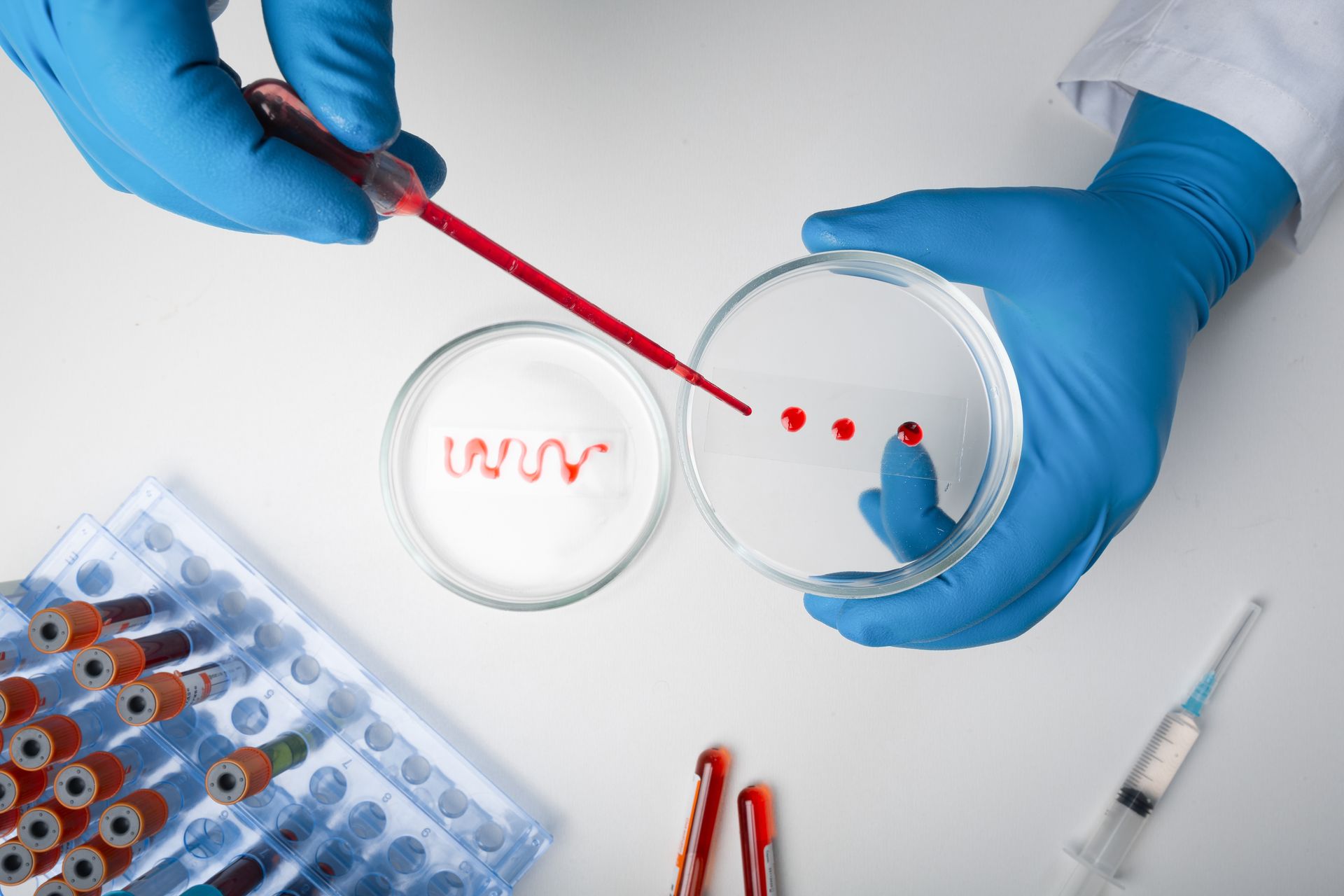Petri dish blood