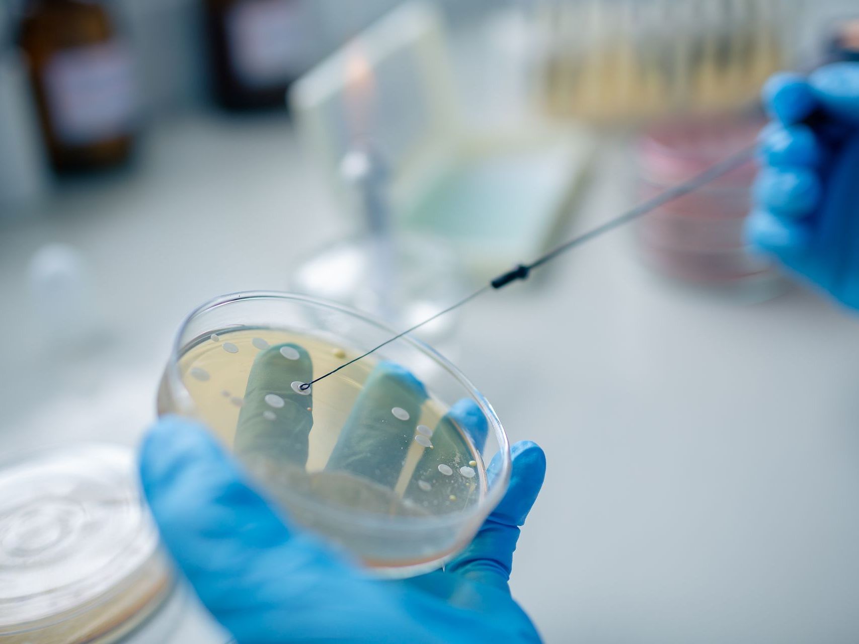 A person is holding a petri dish with bacteria in it.