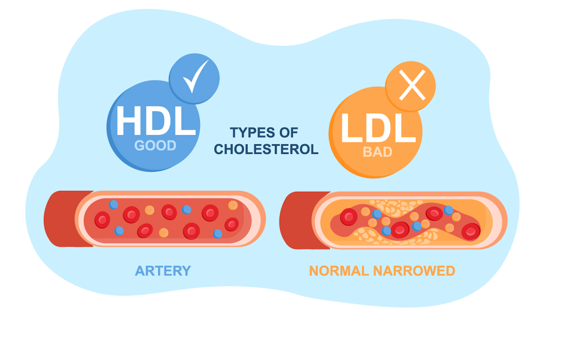 HDL and LDL contrast animation