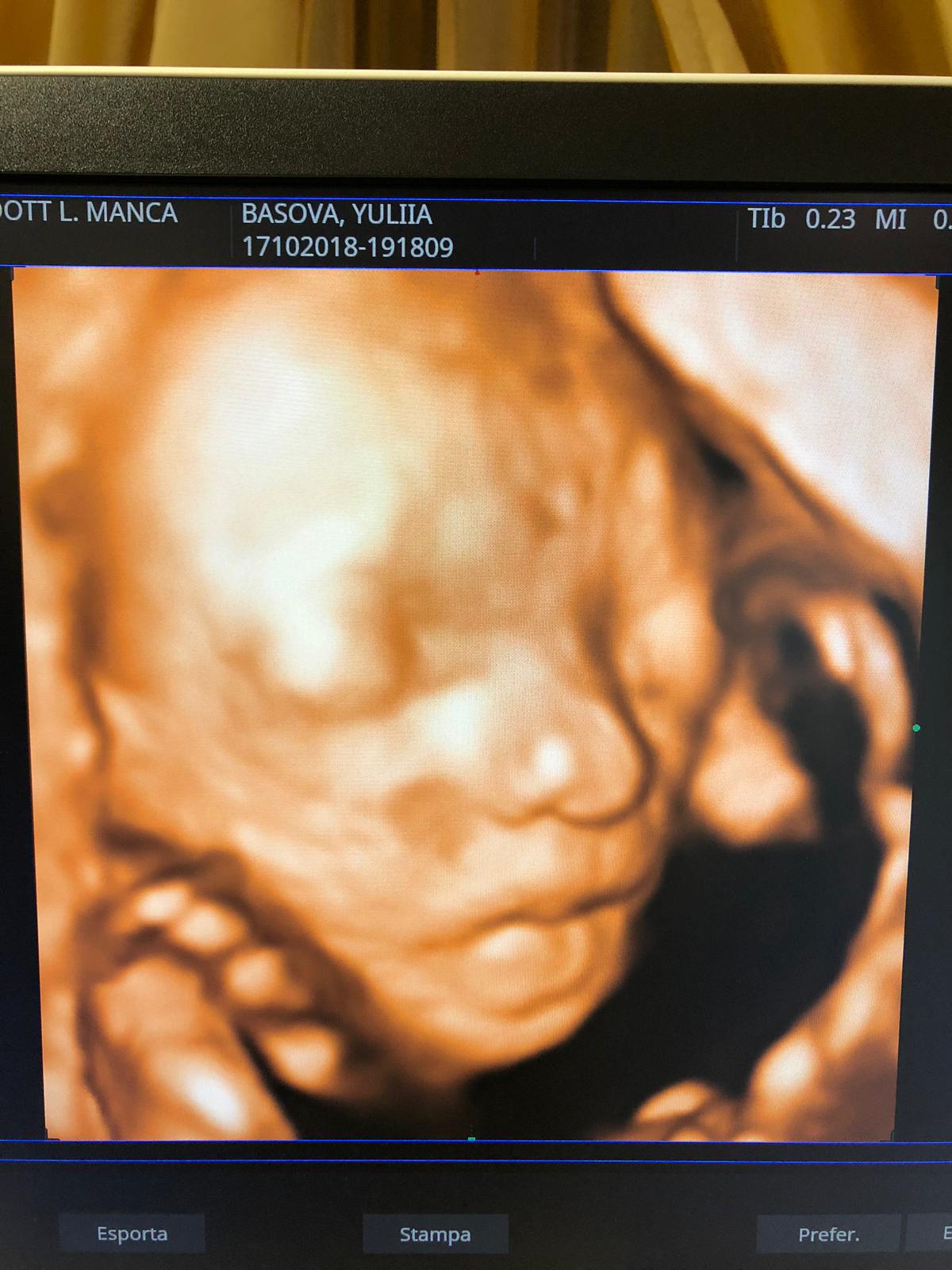 ecografia ginecologica