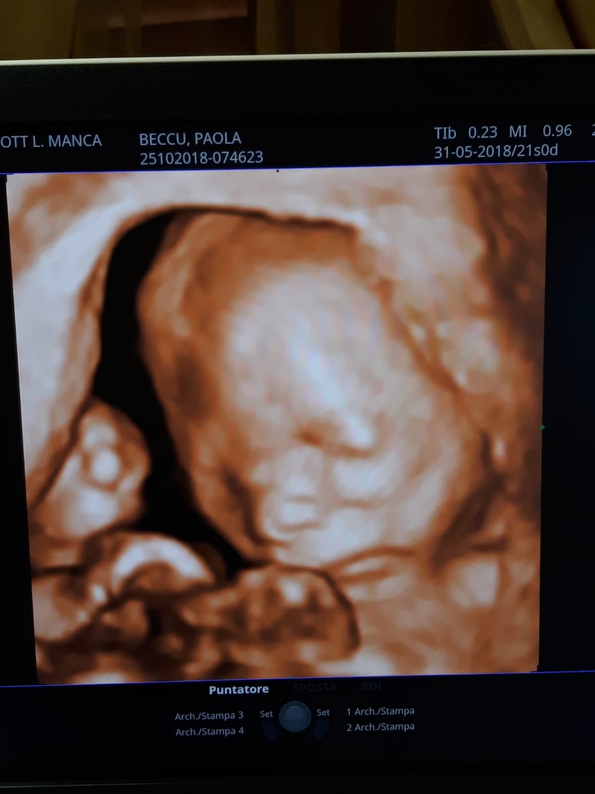 ecografia di un bambino