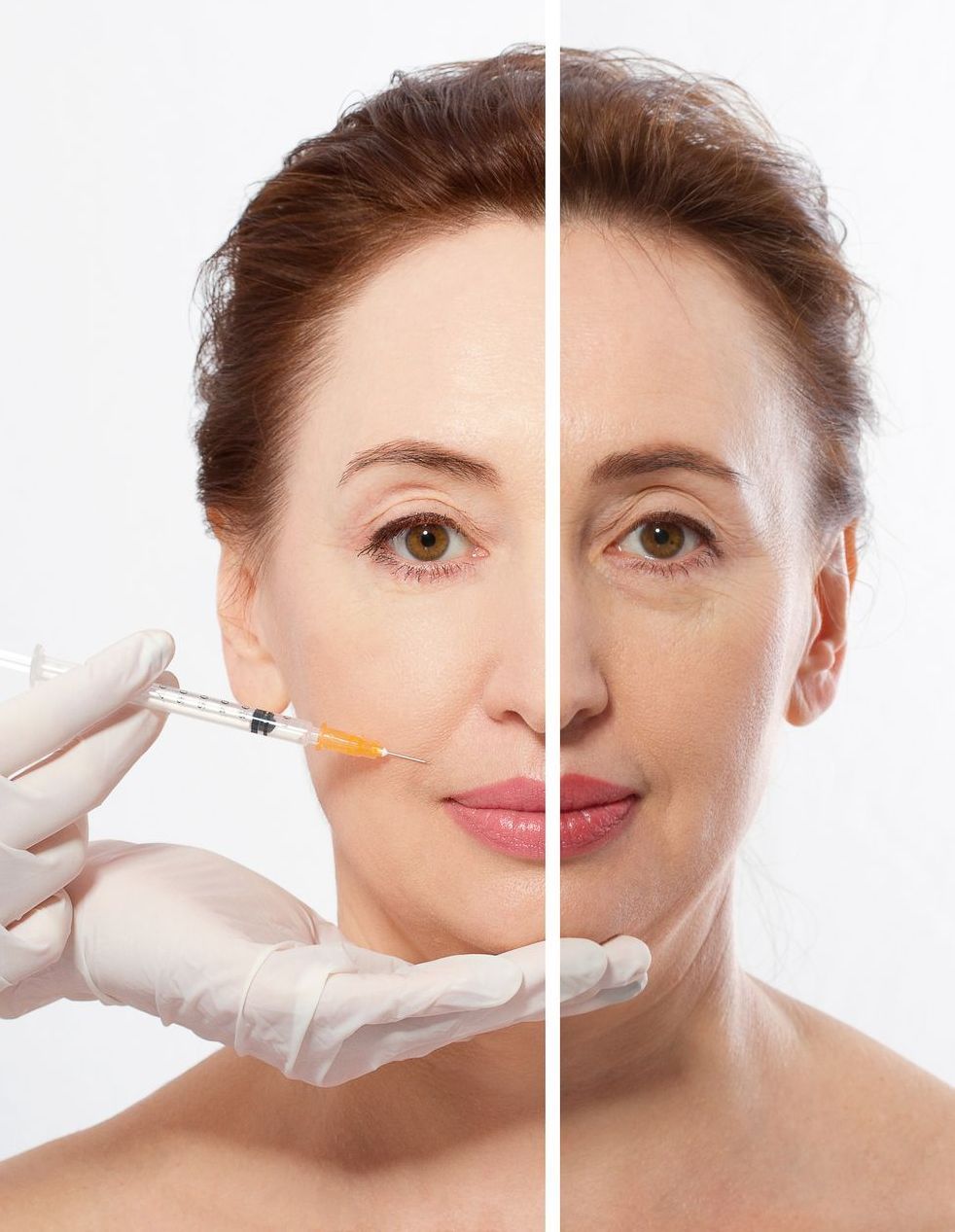 A woman is getting a botox injection in her face.