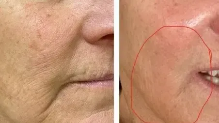 A before and after photo of a woman 's face.