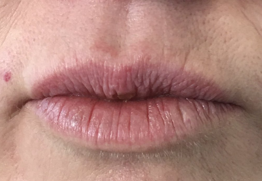 a close up of a woman 's lips with a red spot on her face .