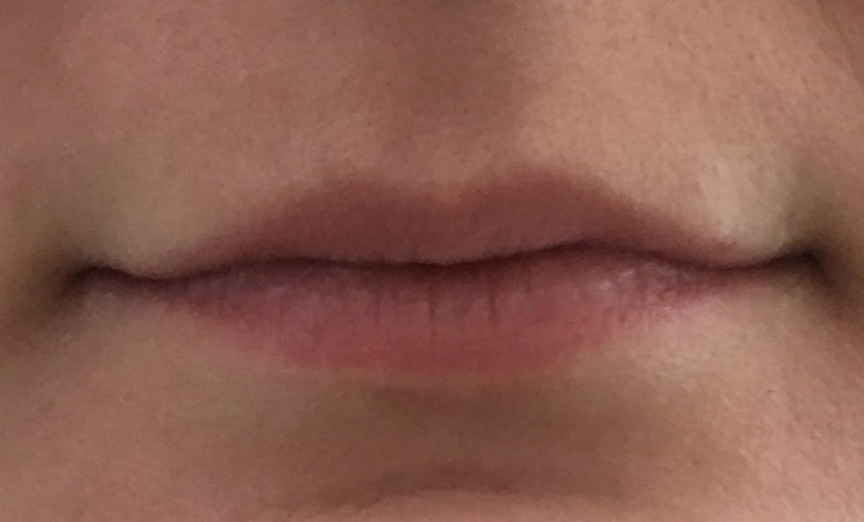 a close up of a person 's lips with no makeup on .