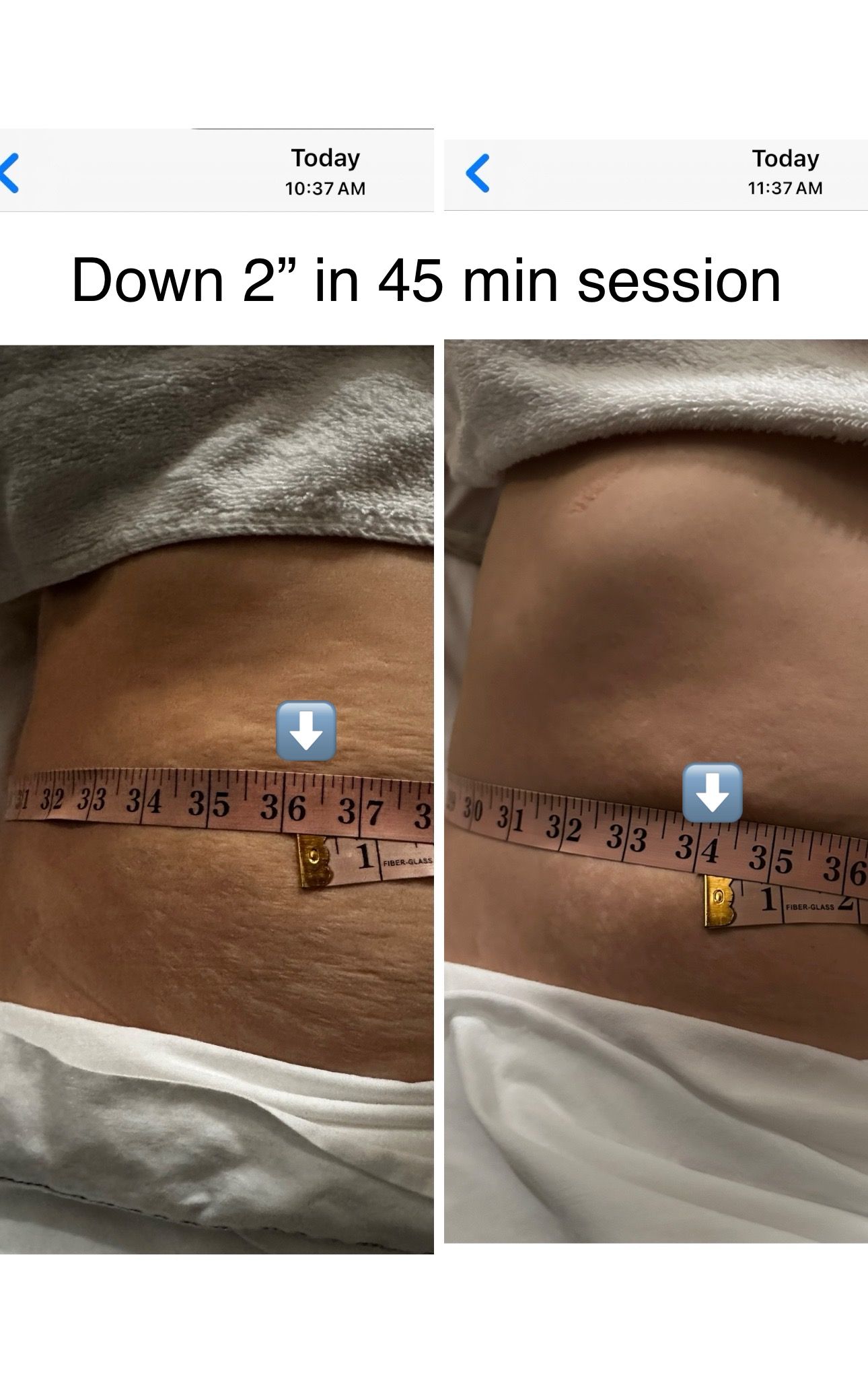 Manual Lymphatic Drainage