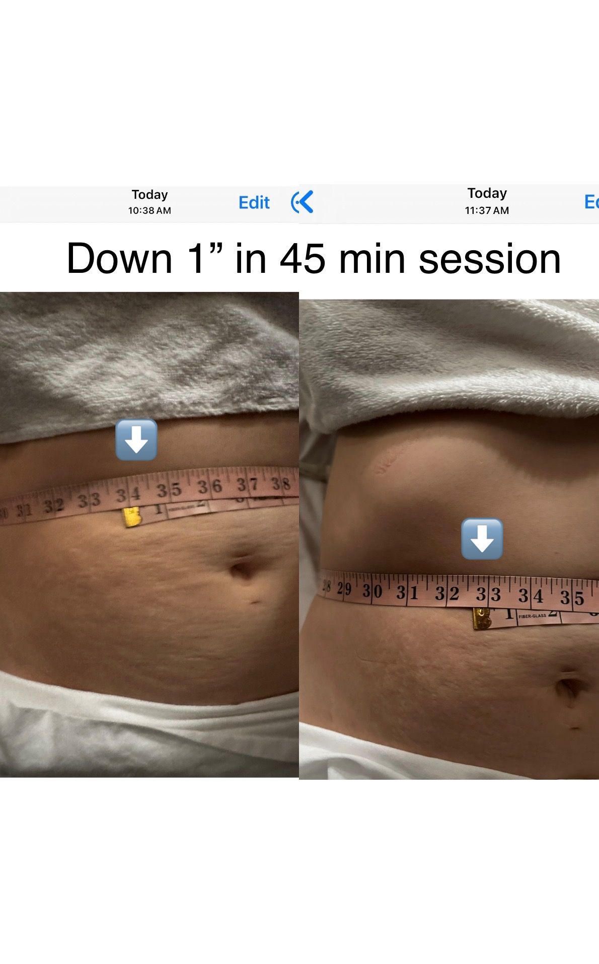 Manual Lymphatic Drainage