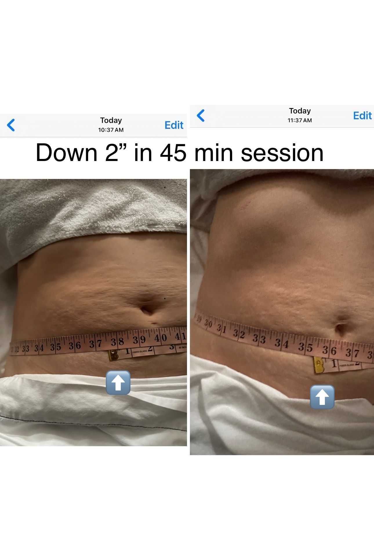 Manual Lymphatic Drainage