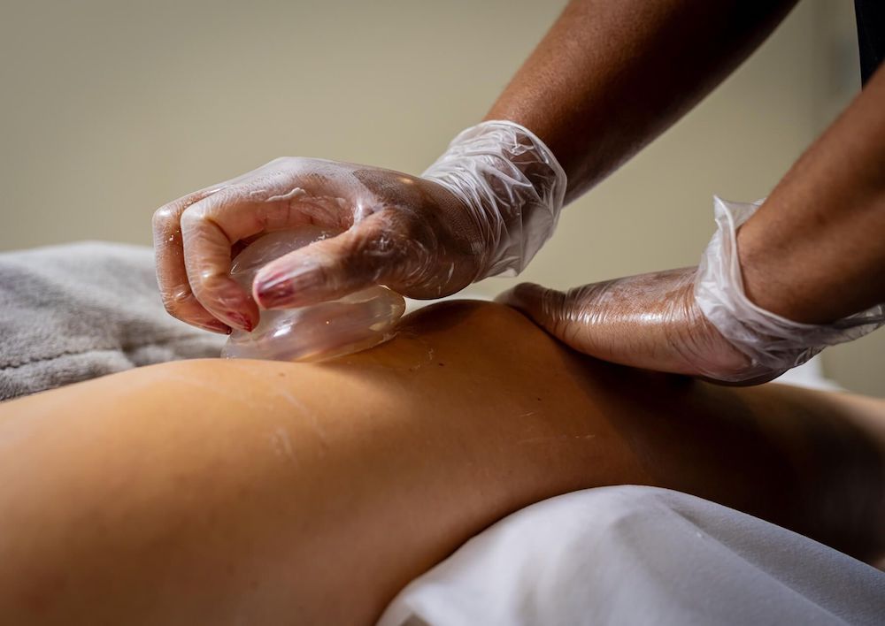 cupping chicago spa