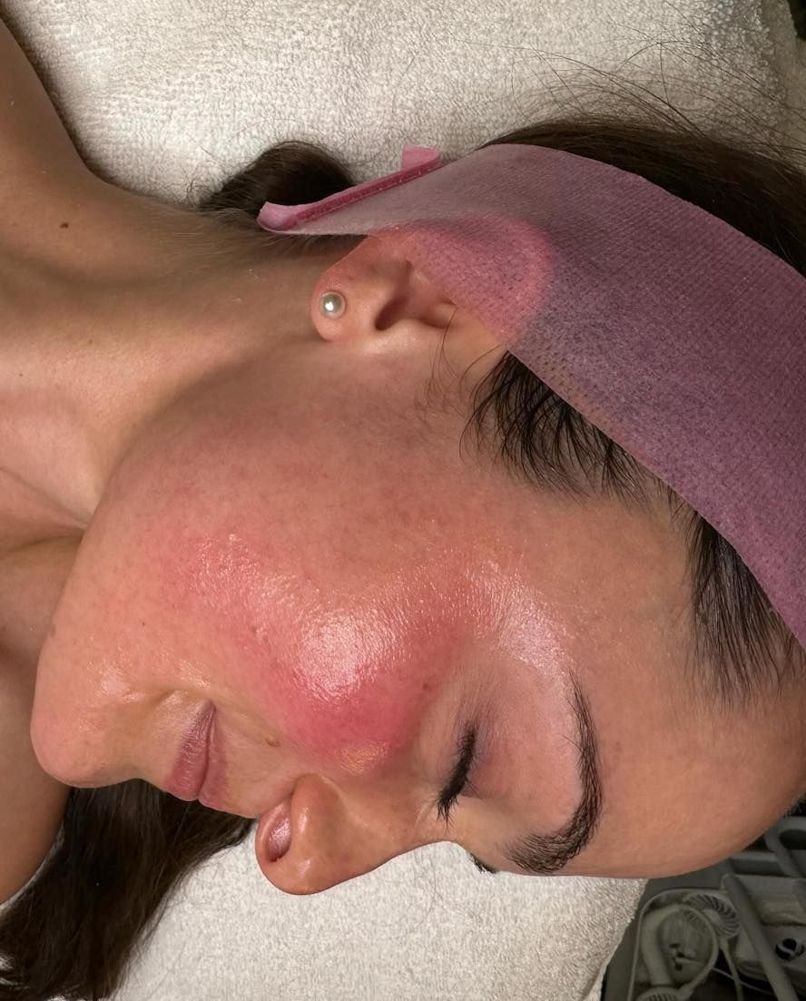 glow facial