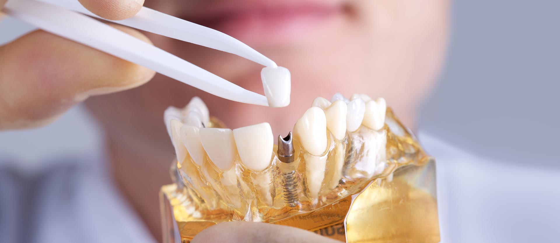 A dentist is holding a model of a person 's teeth with tweezers.