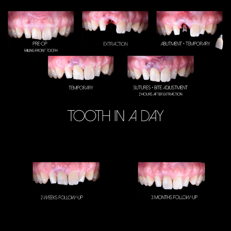 A series of photos showing the 