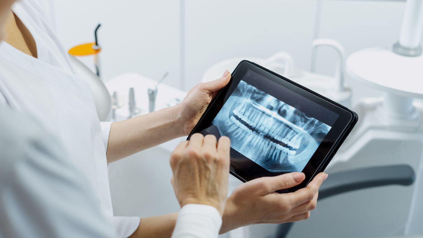 Dentist holding a tablet displaying a dental X-ray in a clinical setting.