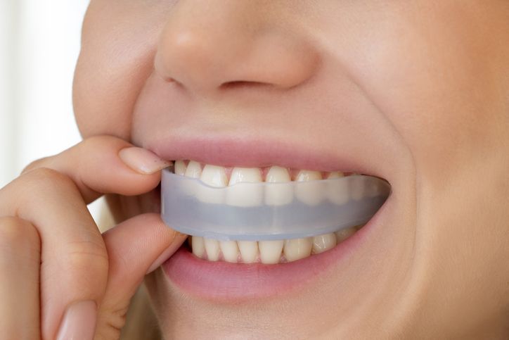 Person inserting a clear mouth guard into their mouth, close-up.