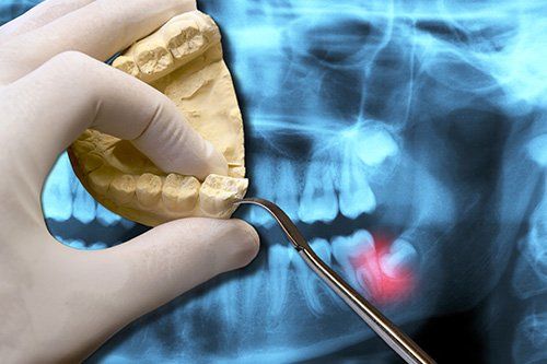 A dentist is examining a model of a person 's teeth in front of an x-ray.
