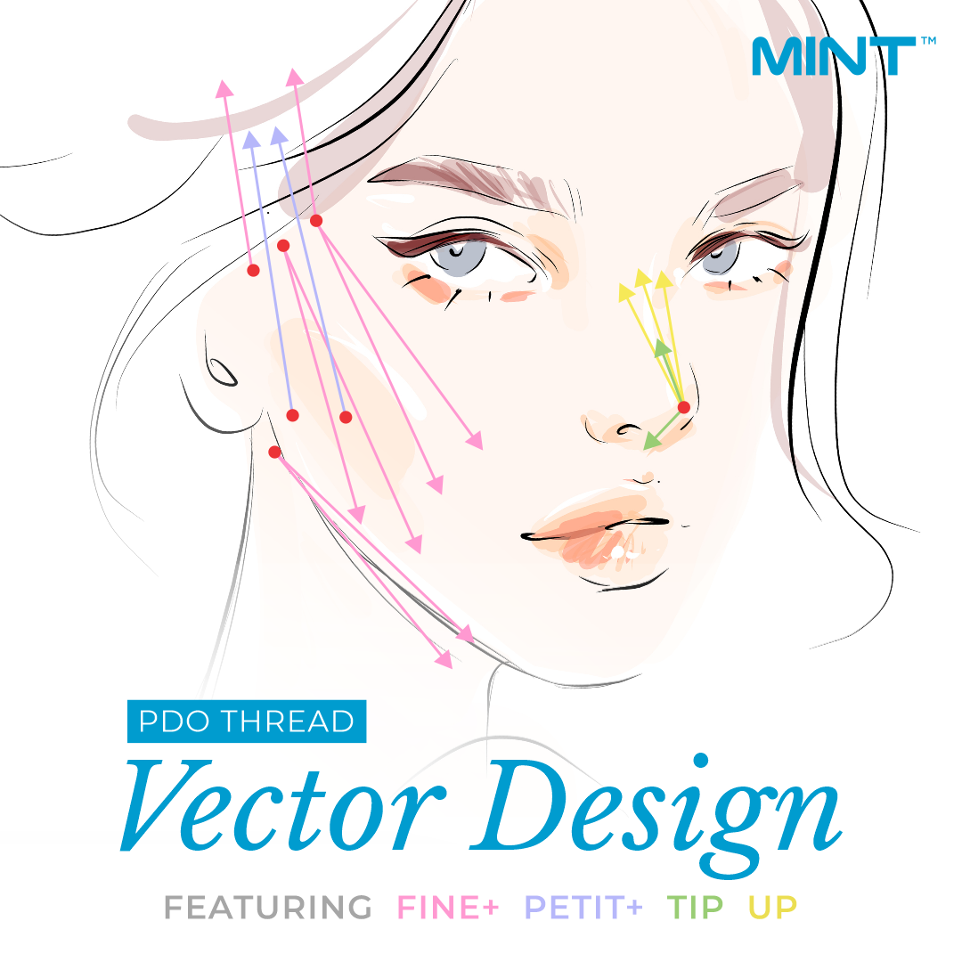MINT PDO vector design for midface, jowls, and neck