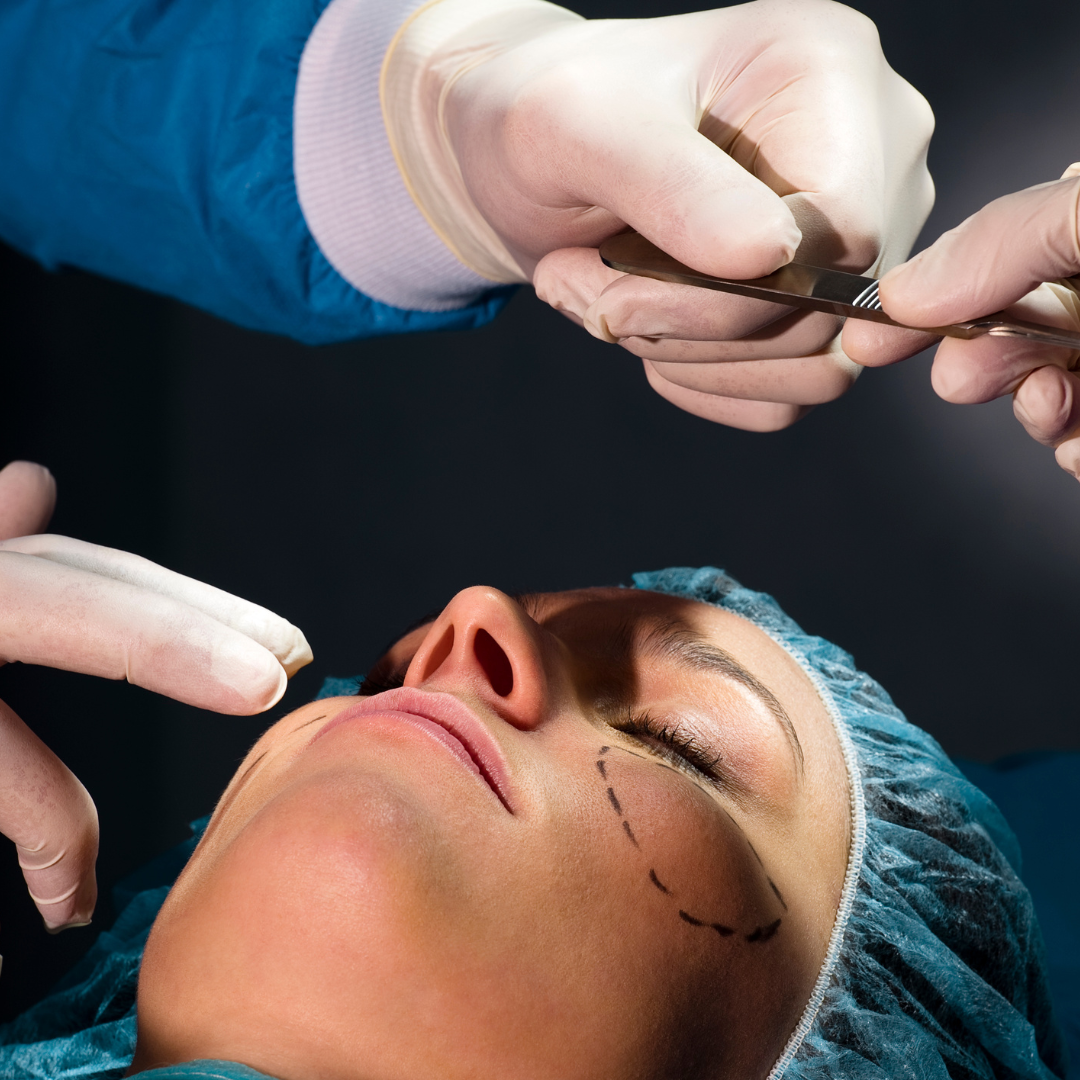 PDO thread lift or traditional facelift
