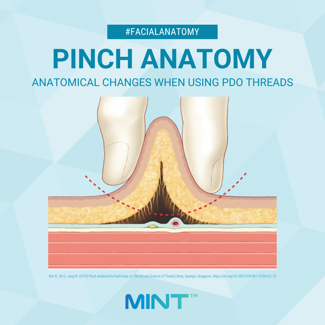 Pinch anatomy illustration for PDO procedures