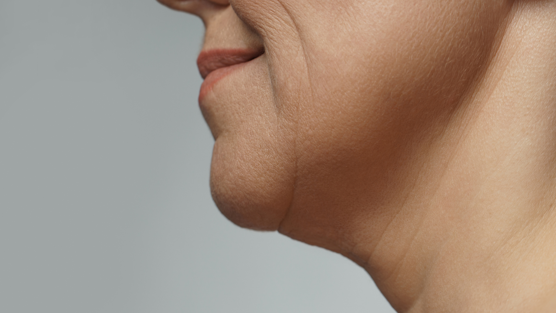 Woman with double chin preparing for pdo thread lift