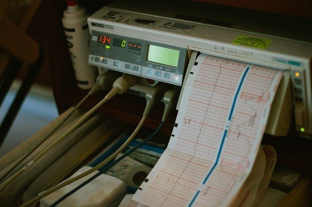 medical equipment printing heart beat