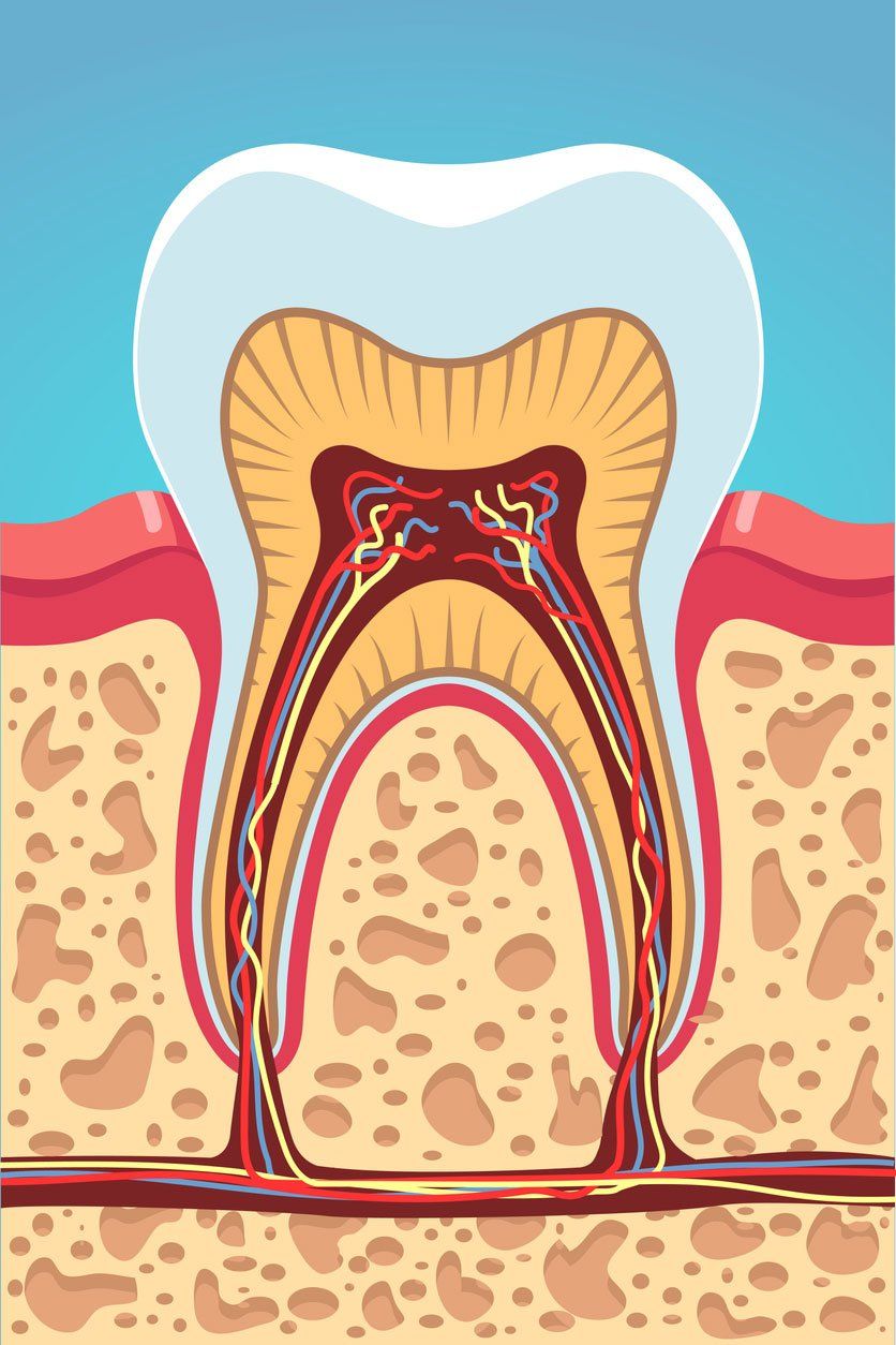 root canal diagram