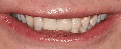 A close up of a person 's mouth with white teeth and red lips.