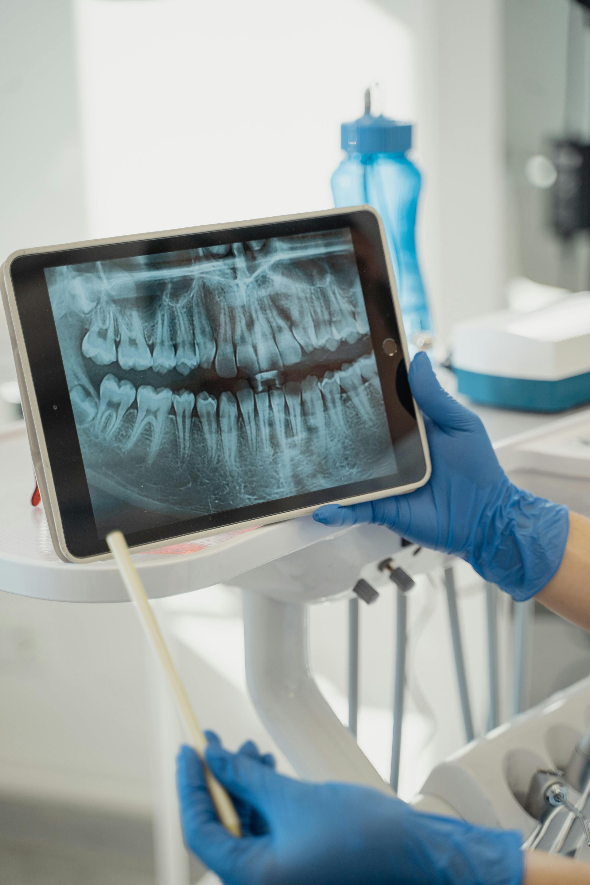 A dentist is looking at an x-ray of a patient 's teeth on a tablet.