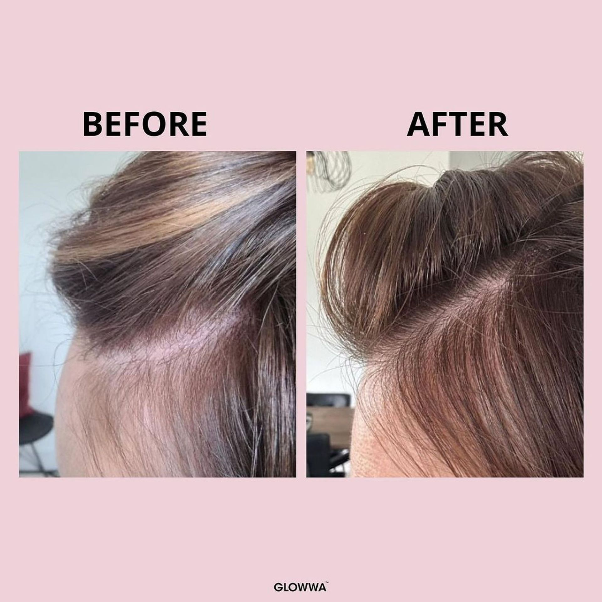 Before and after picture of GLOWWA Hair Food showing improved hair thickness and condition