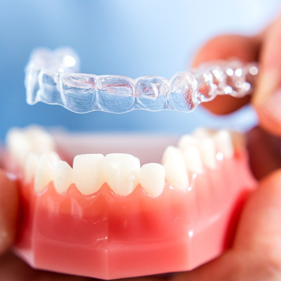 Clear aligners like Invisalign in Mayfield Ohio