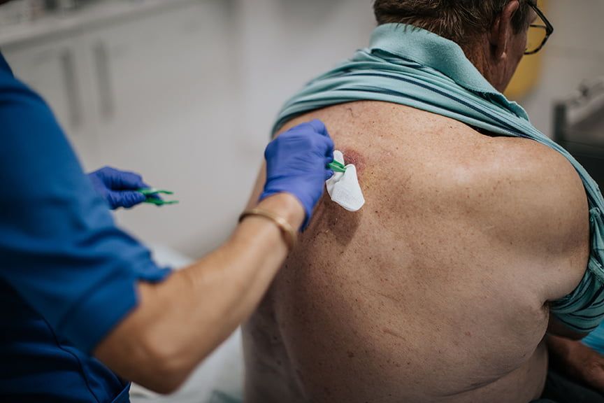 A Nurse Is Treating Wounds On A Patient's Back — Rural Medical Clinic In Manilla, NSW