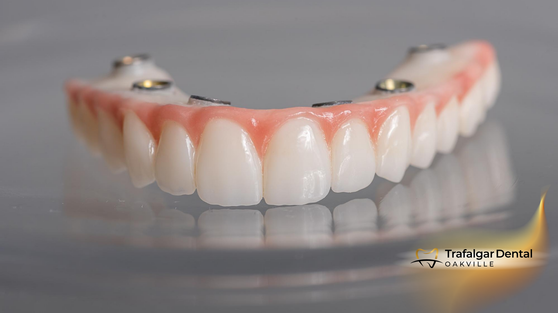 Upper denture with pink gums and white teeth, anchored by metal attachments.