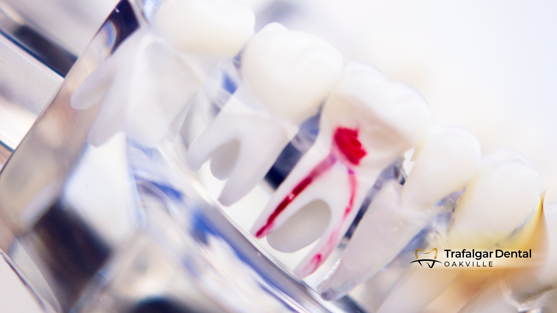 A close up of a model of a tooth with a hole in it