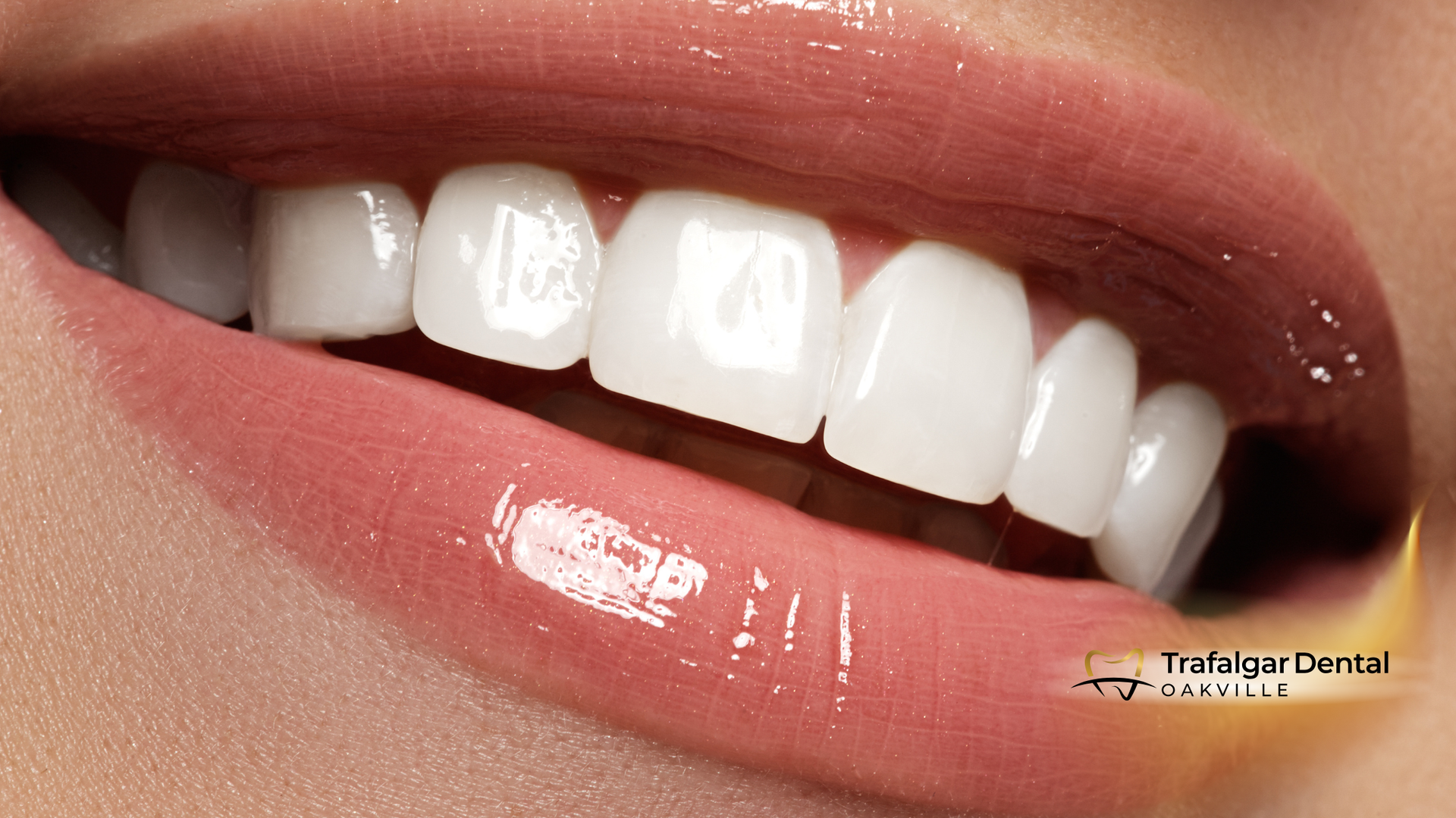 Close-up of a person's bright white, perfect teeth and glossy lips.