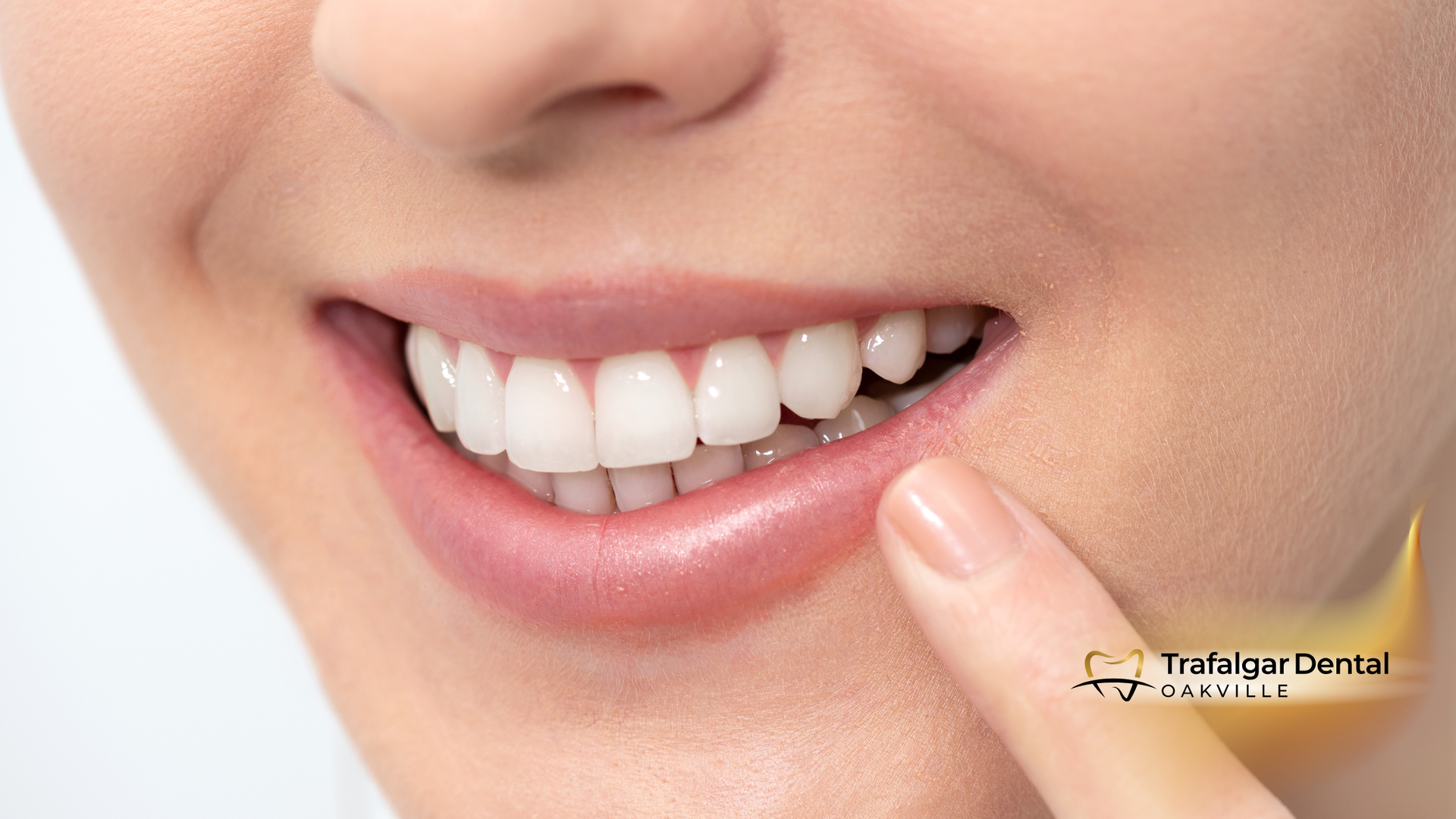 Close-up of a person's smiling mouth, showing bright white teeth; a finger points to the teeth.