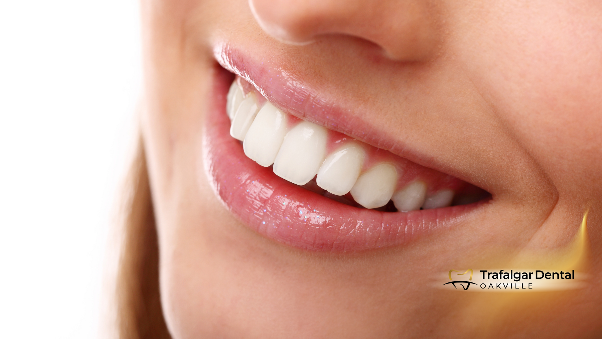 Woman's smiling mouth, showing bright white teeth and full pink lips.