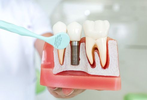 A person is brushing a model of a tooth with a toothbrush.