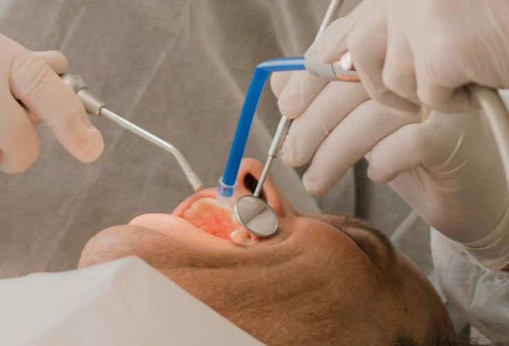 A man is getting his teeth examined by a dentist