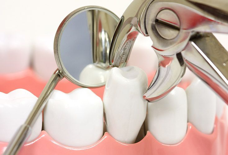 A close up of a person 's teeth being examined by a dentist