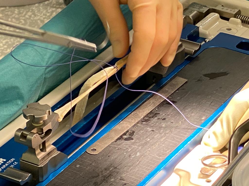 A person is cutting a piece of fabric with a pair of scissors.
