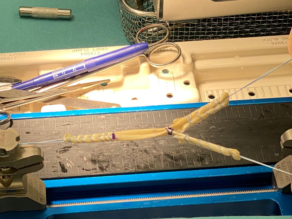 A pair of scissors and a pen on a table