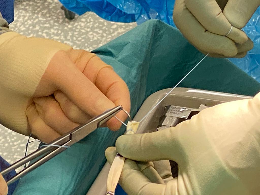 A surgeon is using a pair of scissors to cut a piece of tissue.