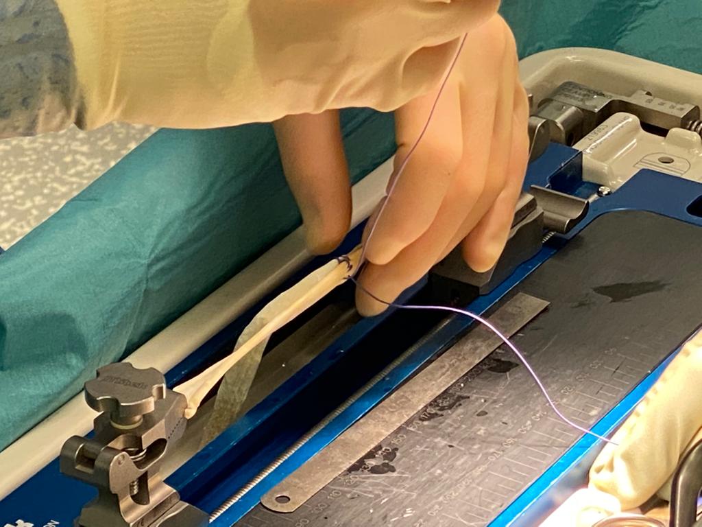 A person wearing gloves is working on a machine