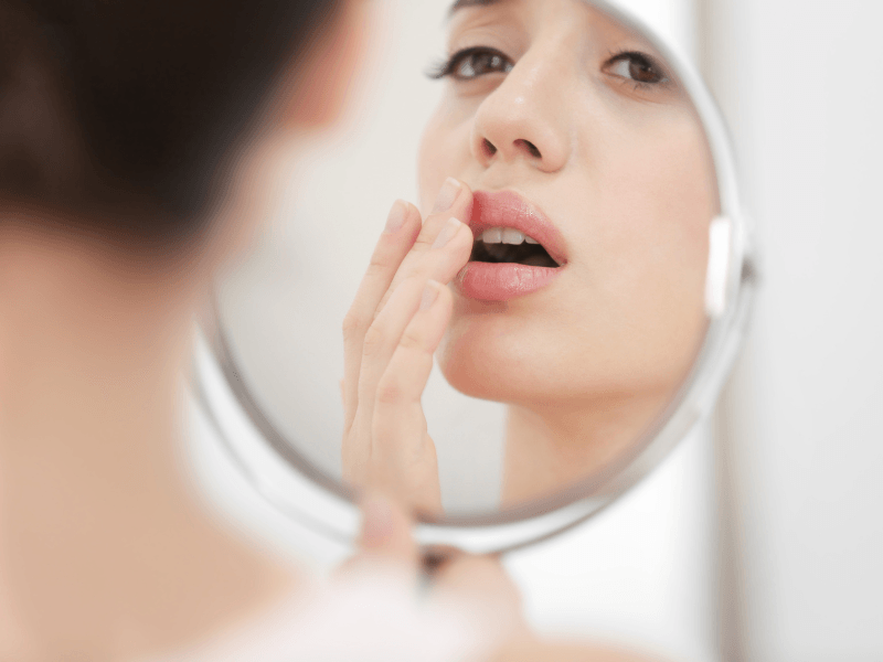 A woman is looking at a cold sore on her lips in a mirror.