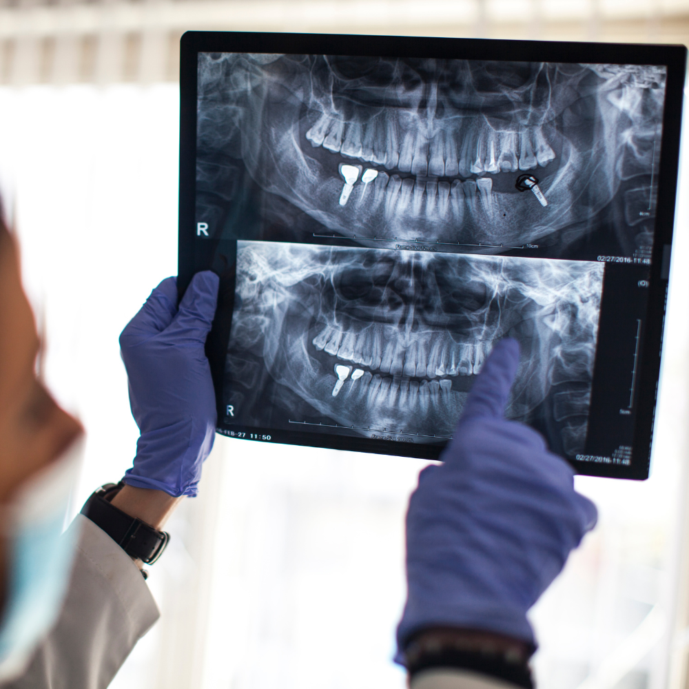 A dentist is holding an x-ray of a person 's teeth while consulting.