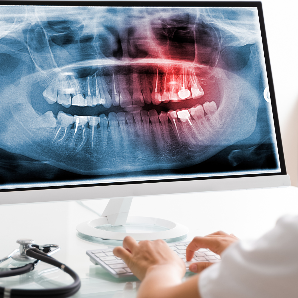 A person is looking at an x-ray of a person 's teeth on a computer screen.