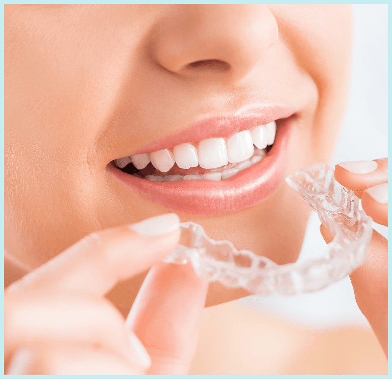 A woman is holding a clear aligner in her mouth.
