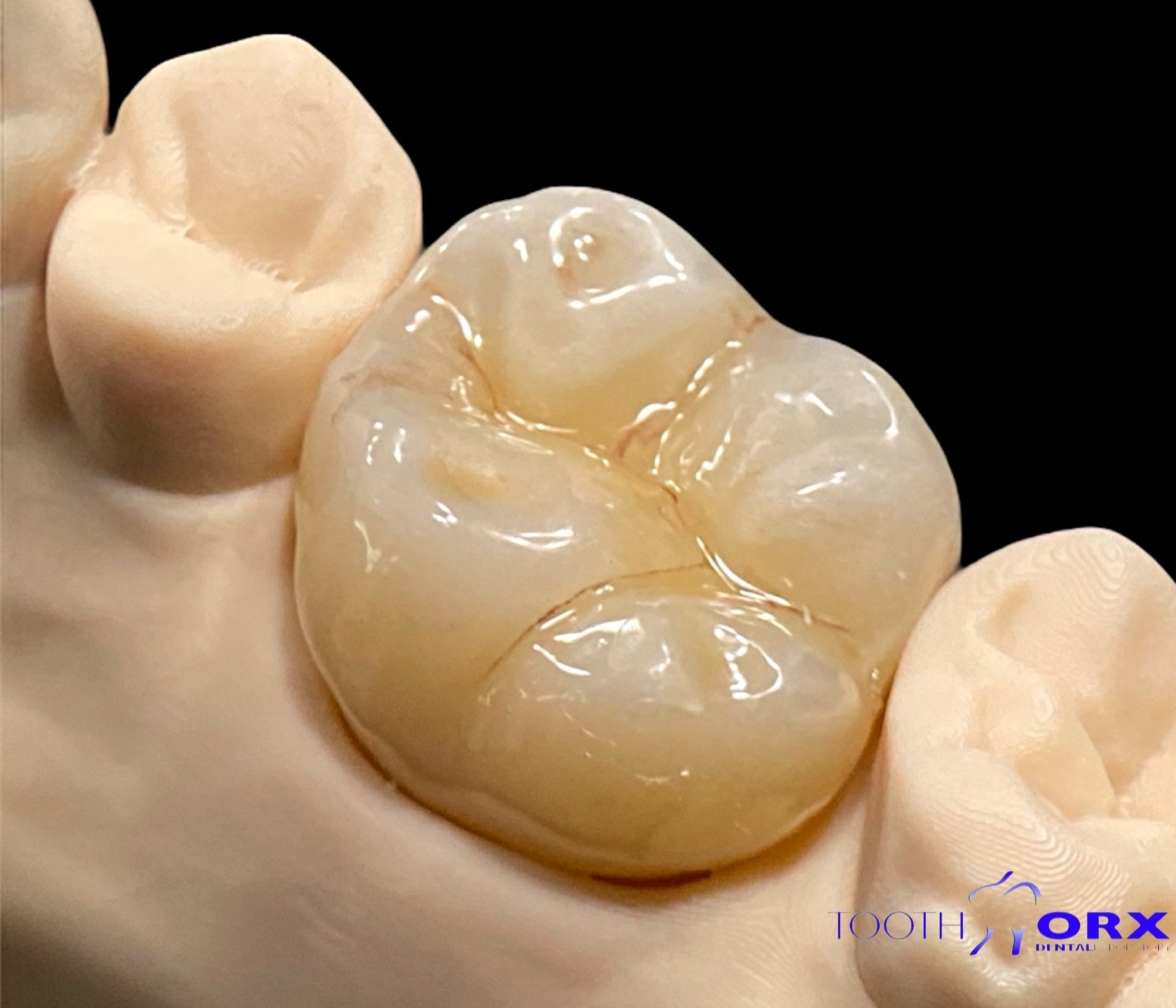 zirconia emax porcelan dentistry dental dentist crowns bridges