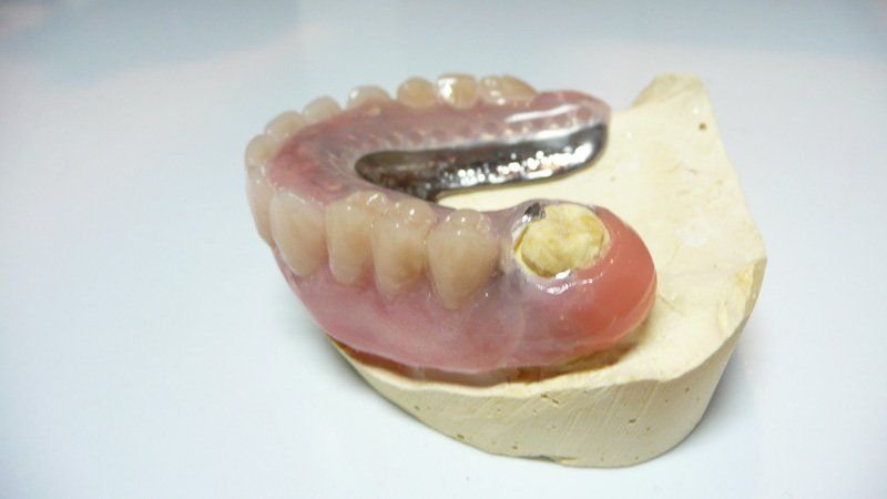 Side view of a denture