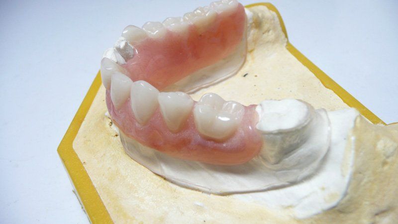 View of a denture